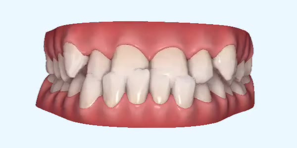 Week 14